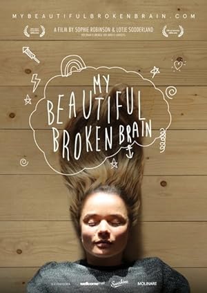 My Beautiful Broken Brain (2016)